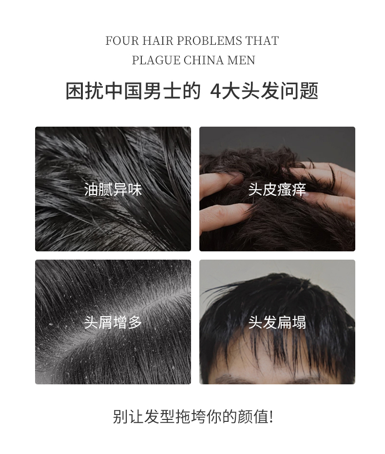 困擾中國男士的四大問題，油膩異味、頭皮瘙癢、頭屑增多、頭發扁塌